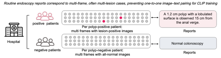 Representative image for A report-grounded vision-language foundation model for colonoscopy from 280000 routine reports