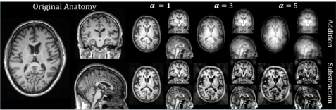 Representative image for The K-Space Signature: Frequency-Domain Representation Learning for Medical Deepfake Detection