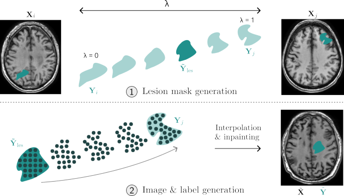 Representative image for OTLesMix: Wasserstein Barycenter and Optimal Transport Map for Synthetic Lesion Generation with Diverse Shapes and Locations