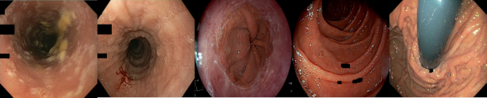 Representative image for Representation-driven Endoscopic Visual Embedding Alignment for Latent Generation