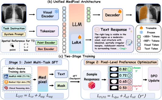 Representative image for MedPixel: A Unified Pixel-Language Model for Medical Reasoning and Segmentation