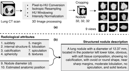 Representative image for ConfTriage: A Calibration-Aware LLM Triage Framework for Pulmonary Nodule Malignancy with Selective Specialist Deferral