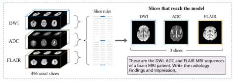 Representative image for PerFact: Perception-Derived Fact Prompting for 3D Brain MRI Report Generation