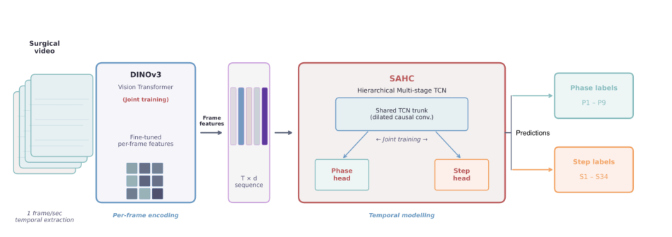 Representative image for Artificial Intelligence for Workflow Analysis in Colorectal Surgery: A Multicentric, Cross-Procedural Development and Generalization Study
