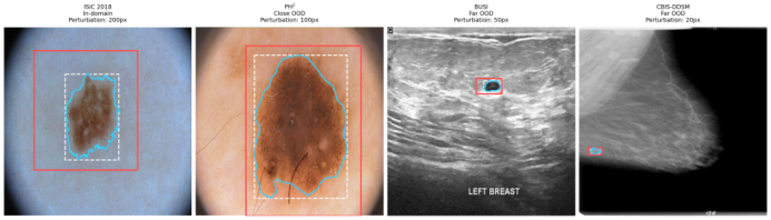 Representative image for When Adaptation Hurts: Connecting Representational Drift to OOD Failures in MedSAM Fine-Tuning