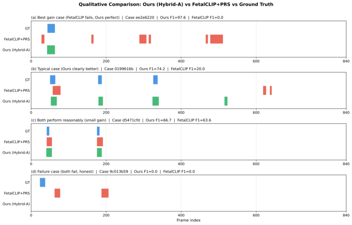 Representative image for Anatomy-Guided Foundation Model Adaptation with Within-Case Prototype Supervision for Standard Plane Detection in Fetal Ultrasound Blind Sweeps