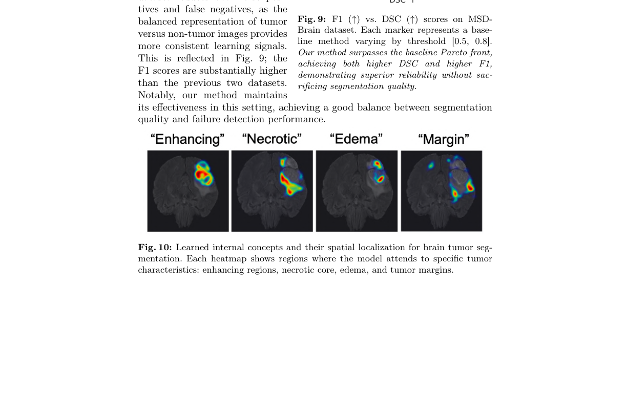 Representative image for Medical AI Encodes a "Feeling of Error": Verifying Cancer Segmentation via Internal Concepts