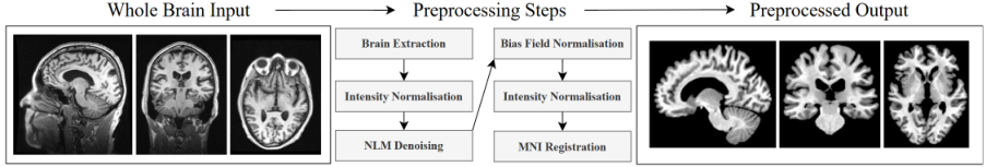 Representative image for Brain-PACE: A Deep Siamese MRI Framework for Modelling Longitudinal Brain Acceleration