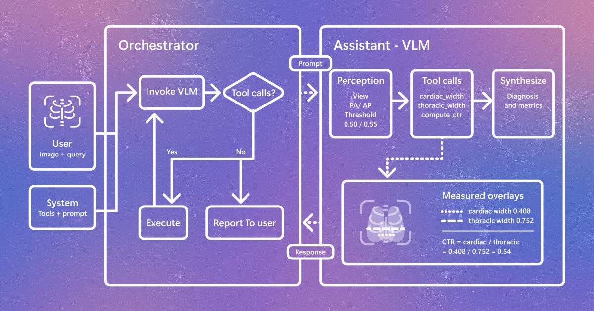 Representative image for Radiology AI is evolving beyond report generation. CARE-X explores a unified approach that combines…